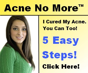 acne no more2